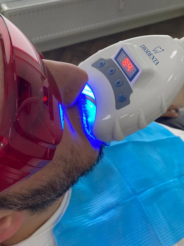 Diodenta – Professioneel tandenbleken